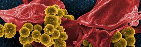 Sekretom mezenchymálních kmenových buněk narušuje biofilm meticilin rezistentního Staphylococcus aureus